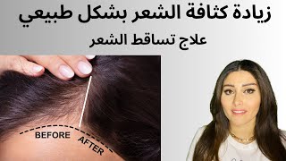 علاج تساقط الشعر وزيادة كثافة الشعر بدون دواء| التغذية المتاحة| نمو الشعر الصحي بشكل طبيعي