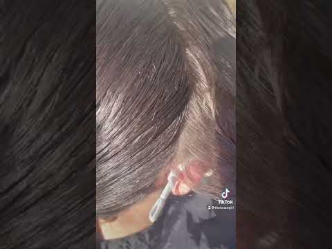 Parents Beware! This Peroxide Lice Hack Saved Us!