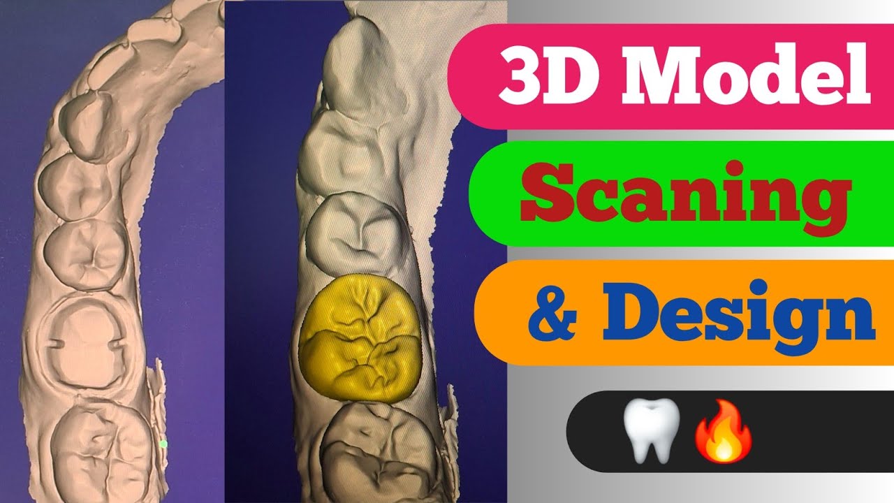 3D Model scaning|| And Zirconia design|| Zirconia Crown design| Dental technician| Dental videos| 