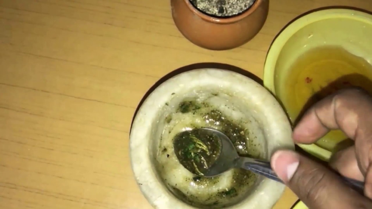 माइग्रेन सर दर्द का 100% ईलाज | 100% solution of migraine pain