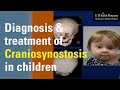 Diagnosis and Treatment of Craniosynostosis in Children