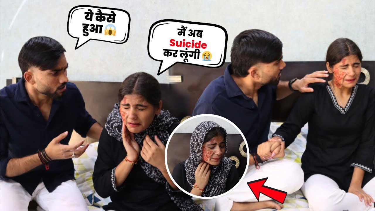 Face Burning Prank On Sourabh 😰💔 || Prank Gone Emotional 😭 || Sourabh Jha