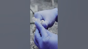 Aligner workflow with resin 3D-printing [Part 5/6]