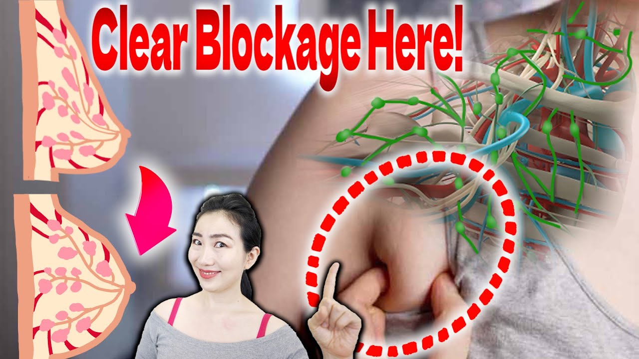 Removing Chest Lymphatic Blockage Massage Drastically Lifts Sagging
