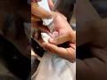 Men’s Nose Extractions