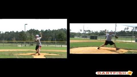 JOI Rehab Biomechanical Assessment Video Analysis - THROWING