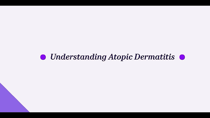 Sanofi – Understanding Atopic Dermatitis
