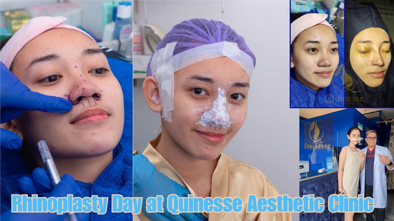 Rhinoplasty Day at Quinesse Aesthetic Clinic