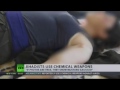 Daesh-ISIL Mercenaries Are Using Chemical Weapons On Kurds