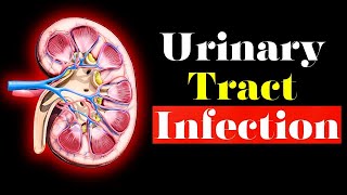 Urinary Tract Infection - Overview (signs and symptoms, pathophysiology, causes and treatment)