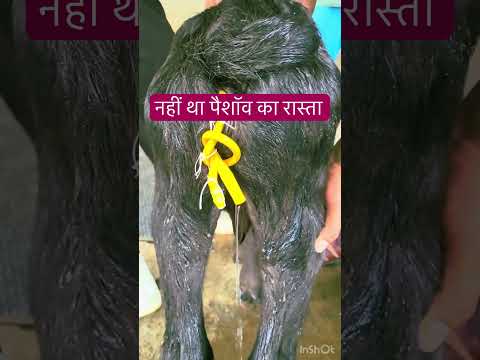 Urethral Agenesis L Urethral Atresia L Retention Of Urine L Dr Umar Khan 