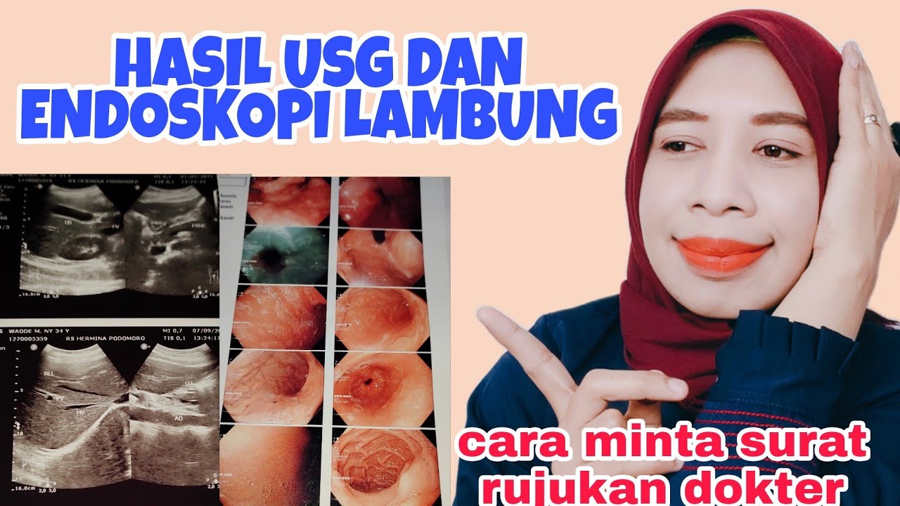 HASIL USG DAN ENDOSKOPI LAMBUNG | CARA MINTA RUJUKAN UNTUK PASIEN BPJS