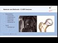 M. Tannast, MRI predictors for failure in FAI surgery, Hip Symposium 2016