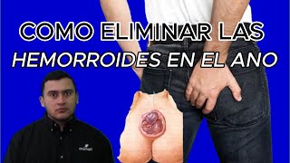muy bien EXPLICADO: ¿COMO ELIMINAR las HEMORROIDES en el ANO?