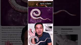 Guinea Worm Disease Dracunculiasis Successfully Eradicated From Earth.