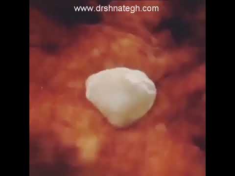 مراحل رسیدن اسپرم به تخمک