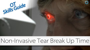OT skills guide: non-invasive tear break-up time