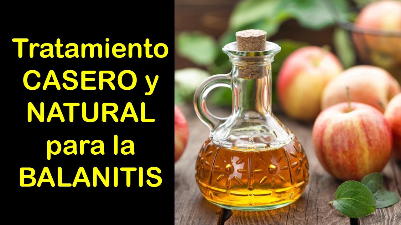 BALANITIS Tratamiento CASERO / Balanitis tratamiento NATURAL