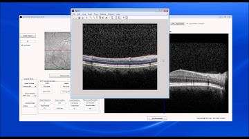 Real-Time Automatic Segmentation of Optical Coherence Tomography Volume Data of the Macular Region