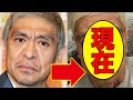 松本人志、今現在の姿が話題に！