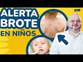 🆘ALERTA BROTE EN NIÑOS, ENFERMEDADES VIRALES - Soy tu Pediatra