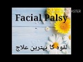 Facial paralysis    treatment by hakeem mubasher ali hassan