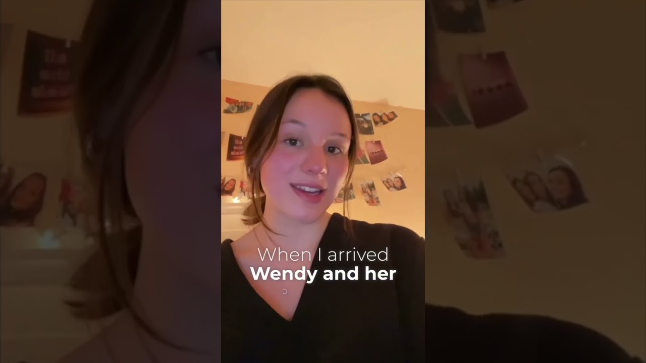 Botox and Filler Before Special Events!