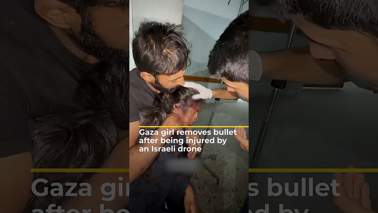 فتاة من غزة تزيل "رصاصة طائشة" بعد إصابتها في رأسها خلال هجوم بطائرة مسيرة إسرائيلية | AJ#shorts