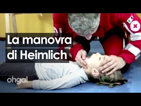 Manovra di Heimlich, la tecnica antisoffocamento per rimuovere un'ostruzione delle vie aeree