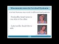 What is cervical dystonia