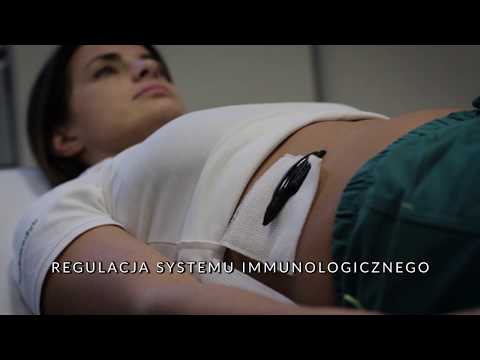 Video: Hirudoterapia - Ošetrenie Pijavicami Doma
