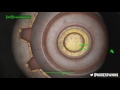 Middle of video