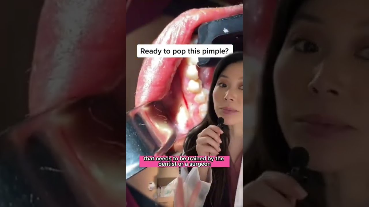 Huge Puss Filled Tooth Infection Dentist Pimplepopper