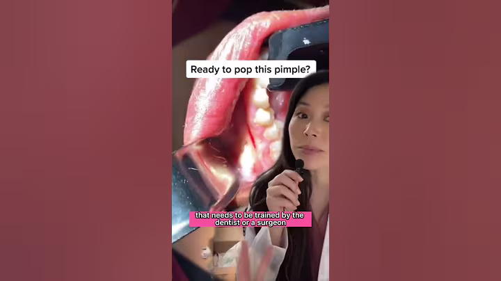 Huge puss filled tooth infection! #infection #dentist #pimplepopper