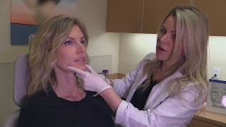 Naficy Rejuvenation Restylane Refyne & Defyne