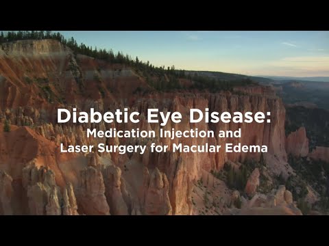 Diabetic Eye Disease: Medication Injection & Laser Surgery for Macular Edema