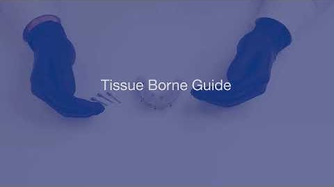 Tissue Borne Surgical Guide