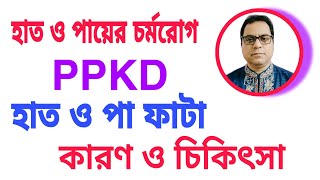 #হাত ও পায়ের চর্ম রোগ #হাত ও পা ফাটা #সোরিয়াসিস #কারণ ও চিকিৎসা #PPKD#PSORIASIS screenshot 4