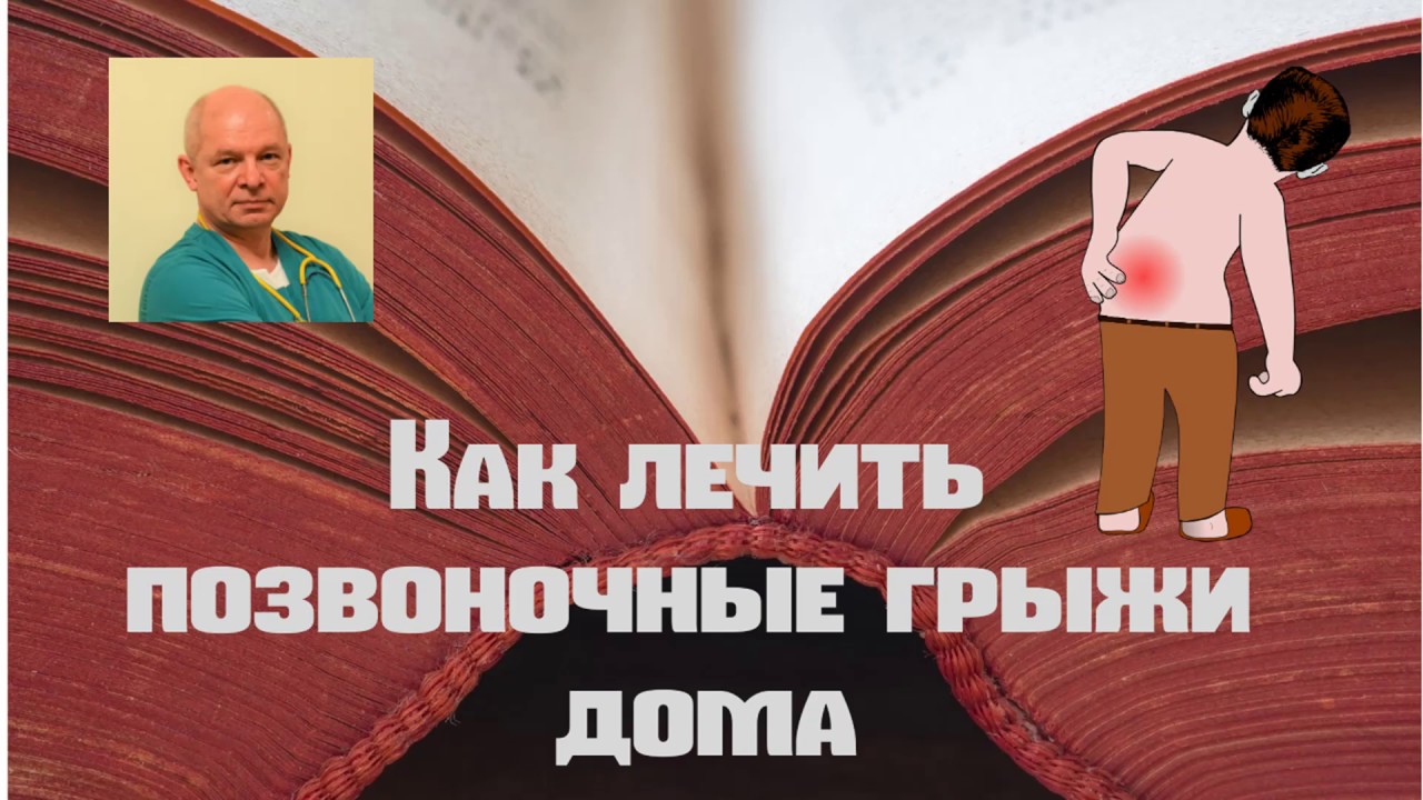 Как лечить банками позвоночные грыжи - YouTube