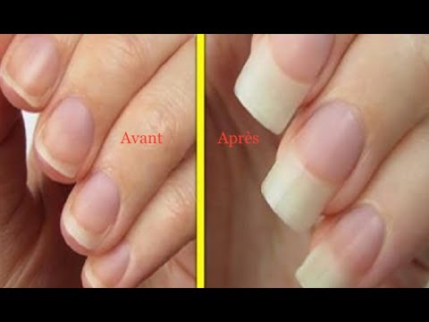 Faire Pousser Ses Ongles 2x Plus Vite Waouh ça Marche Des