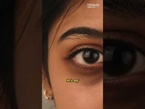 Are You Treating the Wrong Dark Circles? #DermatologistTips #SkincareFacts
