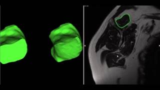 vtkClipClosedSurface  and vtkClipPolyData Wealth