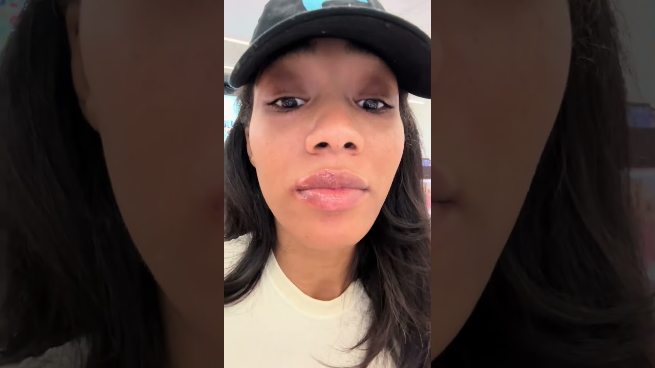 Viral Lip Plumper Review: Does This $50 Product Really Work?