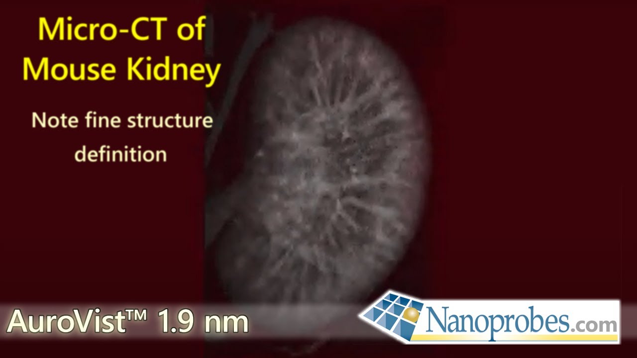 Micro-CT of Kidney with AuroVist™ 1.9 nm