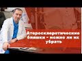 Атеросклеротические бляшки – можно ли их убрать