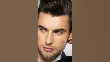 tướng nốt ruồi tài lộc , phú quý của đàn ông trên trán