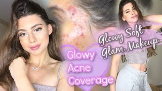 MY ULTRA GLOWY ACNE COVERAGE ROUTINE! || confidence, self esteem, chit chat GRWM!!