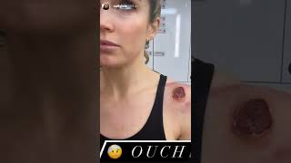 Details Caity Lotz MIX #1 dump News