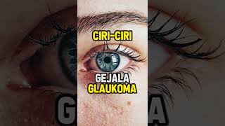 Gejala Glaukoma❗