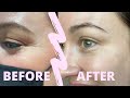 I got BABY BOTOX! My 1st time! 💉✨38 years old